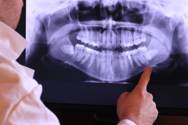 Best Emergency Cosmetic Dentistry in Nanuet, NY